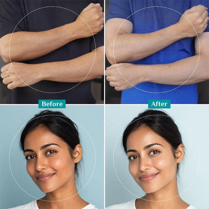 25% AHA, 2% BHA, 5% PHA Peeling Solution || Pilgrim
