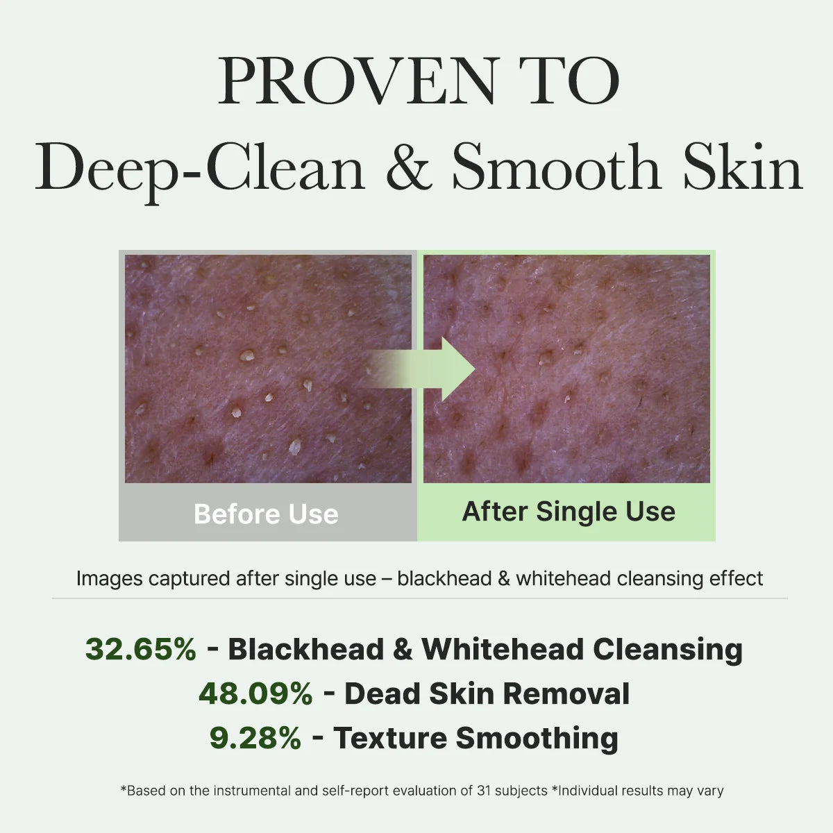 Fresh Green Rice Mochi Cleanser, Gentle Daily|| Cleanser for Acne-Prone Skin||