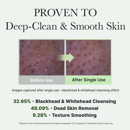 Fresh Green Rice Mochi Cleanser, Gentle Daily|| Cleanser for Acne-Prone Skin||