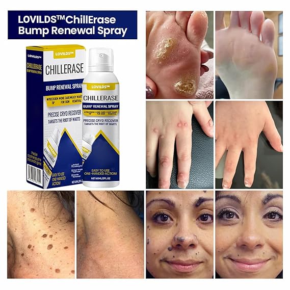 LOVILDS ChillErase Bump Renewal Spray