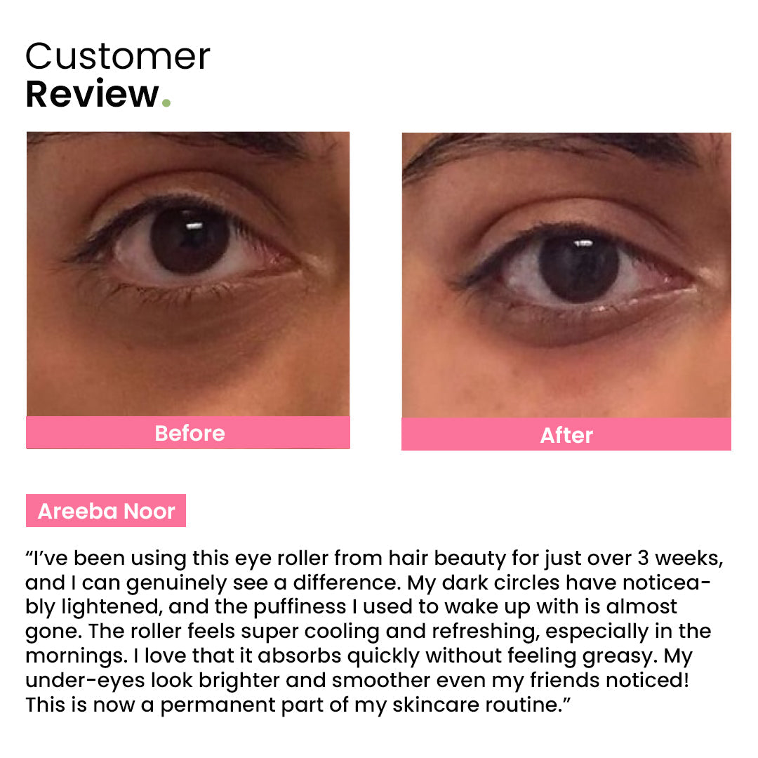 Eye Roller | Eliminates Dark Circles & Puffy Eyes
